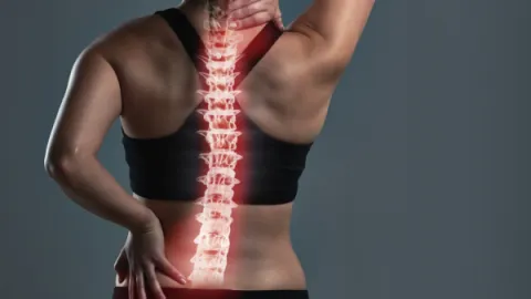 Foto demonstrativa de Escoliose: como identificar e tratar esse desvio postural?