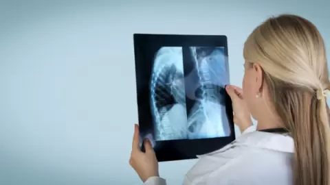 Imagem representativa: Escoliose O Impacto na Postura e a Importância do Tratamento Fisioterapêutico